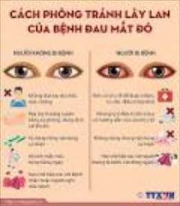 Bệnh đau mắt đỏ, dấu hiệu nhận biết và các biện pháp phòng tránh